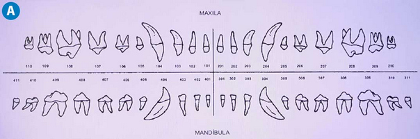 Figura 4 – Odontograma (sistema Triadan) para cães